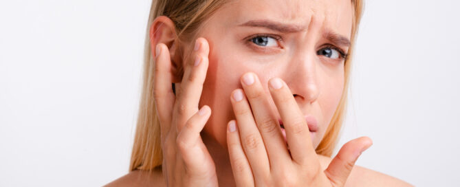 dry skin